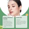 O Gel Hidratante de Aloe Vera Oceaura Suaviza e Hidrata a Pele após a Exposição Solar, Cuida da Pele Facial, Creme em Gel