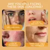 Crema Facial de Cuidado con Veneno de Abeja Crema Hidratante Suave Mejora la Elasticidad de la Piel Rejuvenecimiento Delicado Crema Hidratante Crema Facial