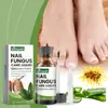 Juego para el Cuidado de Uñas de Manos y Pies Cuidado de Uñas de Pies Onicomicosis Uña Brillante Uña Suave Solución para el Cuidado de Uñas Encarnadas