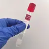 Suministrado Directamente por el Fabricante, Tubos Desechables para Recolección de Sangre Prp con Vacío Acdgelbiotin Tratamiento para la Caída del Cabello Tubo de Recolección de Sangre Prp de Vidrio
