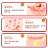 Creme Antibacteriano Especial para Impatiens Líquido Antibacteriano Essência de Ervas Nutre Profundamente a Leito da Unha Creme Antibacteriano Venda por Atacado Entrega