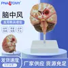 Modelo de Anatomia do Cérebro Humano, Hemorragia Cerebral, Inteligência Arterial, Veia Animal, Malformação, Patologia Cerebral, Auxílios de Ensino do Cérebro