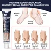Sumifun Creme Transfronteiriço para Edema, Creme para Drenagem e Cuidados com a Saúde, Shopee Lazada Comércio Exterior Inchaço nas Pernas Massagem K10282