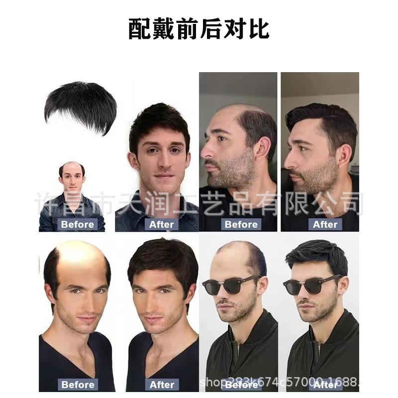 男士发块3