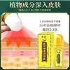 Líquido Penetrante Óseo de Veneno de Escorpión de Xizang 50ml Uso en Casa Aceite Esencial Roll-On Cuidado de la Salud Meridiana Líquido para Moxibustión Aceite de Masaje Relajante Muscular