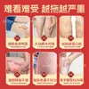Ungüento Beitong Shijia para la Salud Venosa, Ungüento Relajante para Venas para Venas Saltadas, Várices y Congestión de Vasos Sanguíneos