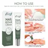 Creme para Cuidado das Unhas Eelhoe Solução para Problemas nas Unhas Cuidado para Mãos e Pés Espessamento Limpeza e Suavização de Problemas nas Unhas Creme para Unhas