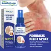 Spray Calmante para Dermatitis South Moon Cuidado para Dermatitis en Manos y Pies Cuidado de la Piel Spray para Cuidado Anti-Hinchazón