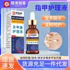 Solución para el Cuidado de Uñas Grises Farmacéutica Yingmei, Líquido para Uñas Grises, Líquido Reparador de Uñas Espesas y Aclarador, Venta al por Mayor y Distribución por Fabricante