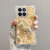 Hazte Rico al Instante con la Nueva Funda de Teléfono de Gama Alta Honor X60 60Plus, Funda Suave X7C y Funda Dorada de la Fortuna X9C