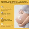 Crema Suavizante de Rosa Ouhoe Hidrata y Elasticiza la Piel, Suaviza la Piel, Cuida la Piel, Refresca, Hidrata y Otorga un Cutis Delicado y Radiante