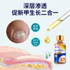 Fungo de Unha Cinza Girassol, Unhas Quebradiças e Rachadas, Creme de Limpeza e Remoção da Superfície da Unha, Unhas Amareladas Espessadas, Fungo de Unha Cinza, Solução Cinza para Unha Quebradiça