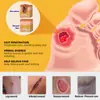 Sumifun Ungüento para Úlceras por Presión de Veneno de Abeja Aliexpress Amazon Transfronterizo Cuidado de Úlceras por Presión Salud del Anciano K10244