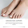 Solución para el Cuidado de Uñas Laniska Fórmula Suave para Cuidar la Superficie de las Uñas y Mejorar su Brillo, Solución de Cuidado Diario