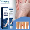 Producto de Venta Caliente Transfronterizo Crema Calmante Herbal para Piernas South Moon Cuidado Suave de Masaje Diario Crema Ligera para Piernas