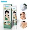 Sumifun Amazon Temu Creme para Manchas Brancas Creme para Cuidados com a Pele K10109 Pomada para Vitiligo