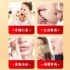 Adesivo para Pés Yuanqi Poria Oito Tesouros, Adesivo para Pés Old Beijing, Adesivo para Pés Quente em Cima Frio em Baixo, Adesivo para Pés de Artemísia, Adesivo para Pés Calmante de Cúrcuma, disponível para atacado