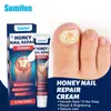 Sumifun Comércio Exterior Shopee Lazada Amazon Creme de Veneno de Abelha para Onicomicose Creme para Cuidados com a Saúde da Onicomicose K10385