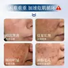 Alga azul microcristal salón de belleza especial melatonina reparación microaguja reducción de poros control de grasa desvanecimiento de marcas de acné muestra venta al por mayor