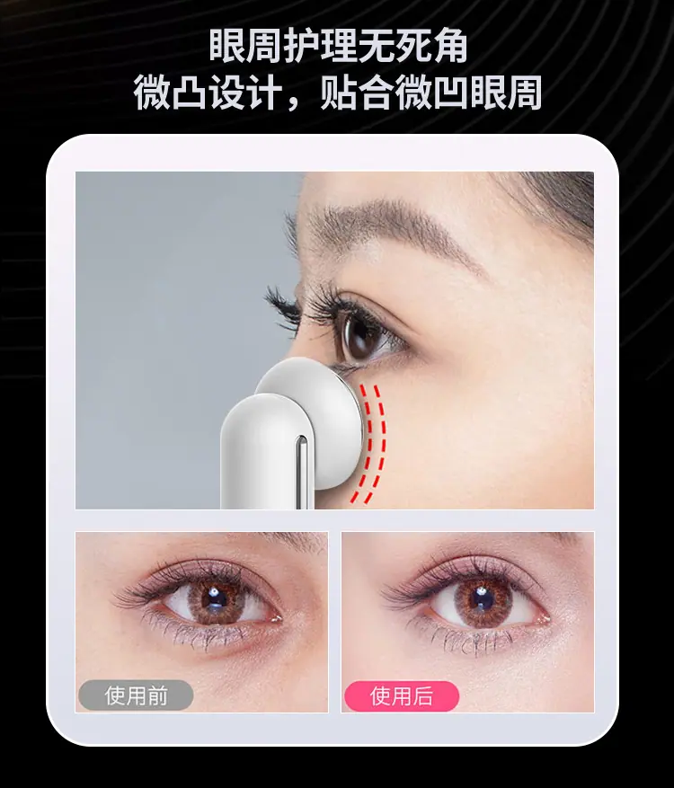 S2309R-眼部射频仪详情页_04.jpg