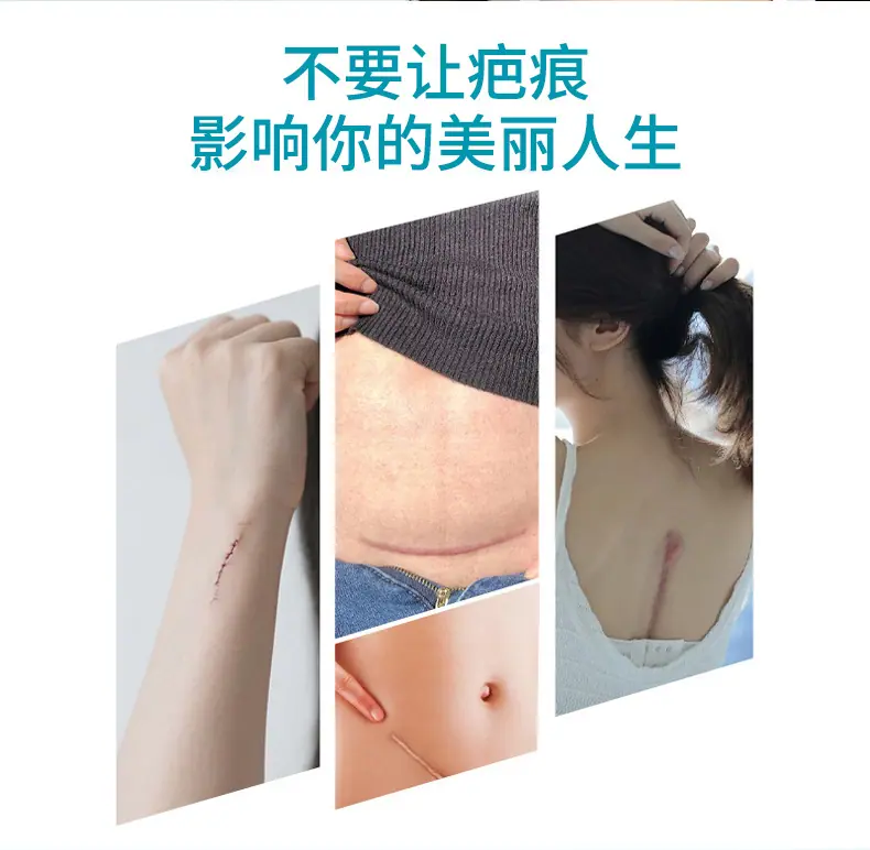 医用疤痕修复剂详情8