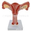 Modelo anatómico patológico del útero reproductor femenino humano. Modelo didáctico del ovario vaginal. Material didáctico sobre reproducción ginecológica.