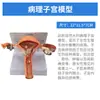 Modelo de Anatomía y Patología del Útero Reproductivo Femenino Humano, Modelo de Enseñanza de Vagina y Ovario, Materiales Didácticos de Ciencia Reproductiva Ginecológica