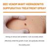 El Spray Suavizante de Veneno de Abeja Ximonth es un Spray Hidratante Suave, Refrescante y Cómodo que Sella la Humedad y Cuida Todo el Cuerpo