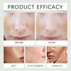 Crema Facial Wiyun Transfronteriza Hidratante, Humectante y Aclaradora de Manchas Faciales, Crema Hidratante, Suavizante y Iluminadora de la Piel