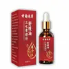 Óleo Calmante de Panax Notoginseng e Drynaria 30ml - Atacado e Distribuição por Ali Pharmacy, Douyin, Kuaishou, Conta de Vídeo e Pinduoduo
