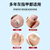 Pluma Sos Alemana para Hongos en las Uñas, Gel Antibacteriano para Protección, Mantenimiento y Cuidado de las Uñas Todo en Uno, No Necesita Quitarse las Uñas, Reparación de Uñas