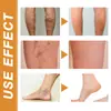 Serie de Cuidado de Piernas South Moon Ungüento Masajeador Suave para el Cuidado de la Piel Spray para Piernas