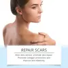 Laniska Adesivo para Cuidados com a Pele Cuidado Diário Suave para a Pele Hidratação Suave Adesivo para Cuidados com a Pele Delicada