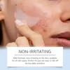 Parche para Acné Ouhoe Luna Cuida la Piel con Acné, Parche Transpirable Facial Suave Limpieza Cuidado Diario
