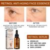 Eelhoe Esencia Facial de Retinol Cuidado Suave y Delicado para el Cuidado de la Piel Facial Esencia