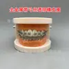 Modelo ortodôntico dental modelo autoligante de cermet oral display de comunicação médico-paciente ambulatorial modelo dental de ensino