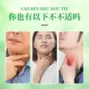 Parche Calmante Herbal para la Garganta por Sequedad y Picazón Estacional, Parche de Ajenjo para Garganta Irritada, Parche para la Garganta, Artículo Popular de Douyin, Al por Mayor en Stock