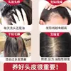 Champú de Hoja de Tuya Platycladus, Cuidado del Cabello con Planta Shouwu, Sin Silicona, Anticaspa, Antirritación, Control de Grasa, Herbal, Medicina Herbal China Natural