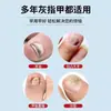 Pluma Herbal Antibacteriana Alemana para Hongos en las Uñas, Uso Externo Calmante Herbal Suave Extracto de Planta Crema Reparadora de Uñas, Dropshipping Disponible