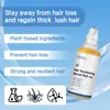 Esencia Transfronteriza para el Cuidado del Cuero Cabelludo Sérum para el Crecimiento del Cabello Aceite Esencial de Romero Rodillo Bolita Aceite Esencial para el Cuidado del Cabello