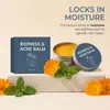 Creme facial para cuidados transfronteiriços 50g, creme de cuidados faciais refrescante e para limpeza de acne, equilibra suavemente o óleo da superfície da pele