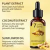 Aceite Esencial Nutritivo para Folículos Capilares Color Jengibre Mismo Estilo Transfronterizo, Aceite Esencia para Cuidado del Cabello y Masaje del Cuero Cabelludo, Soporta Procesamiento Personalizado