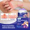ERAYCEE Crema Antiprurítica para la Piel de Viola viride a Base de Hierbas Transfronterizas No Irritante Uso Externo Picaduras de Mosquito Crema de Uso Externo