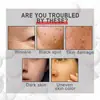 Crema Facial de Colágeno Eelhoe Transfronteriza Hidratante Nutritiva Cuidado de la Piel Facial Crema de Colágeno para la Piel