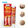 Sumifun Crema Relajante para Piernas Hinchadas Crema para la Salud Crema de Uso Externo Yeso Herbal de Comercio Exterior K10162