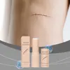 Bálsamo Hidratante para Cicatrices en la Piel Suaviza y Acondiciona la Piel, Hidrata la Piel del Rostro y el Cuerpo, Apariencia de Cicatrices, Crema de Cuidado Diario