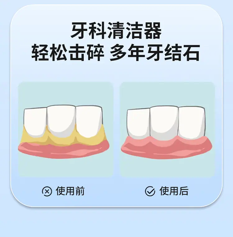 洁牙器-拷贝_10