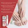 Caneta Xorita para Cuidado das Unhas, Cuidado Suave e Limpeza para Mãos e Pés, Brilho Natural e Translucidez, Caneta de Cuidado Portátil