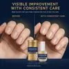 Aceite Nutritivo para el Cuidado de las Uñas con Ingredientes Suaves para Hidratar y Dar Brillo a Manos, Pies y Uñas, Suavizando la Superficie de las Uñas, Aceite Esencia para el Cuidado, Transfronterizo