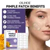 Parche para Acné Ligero OUHOE Cuidado Suave y Cómodo para la Piel del Rostro, Cuidado de la Piel Limpia, Parche para la Piel de Material Transpirable